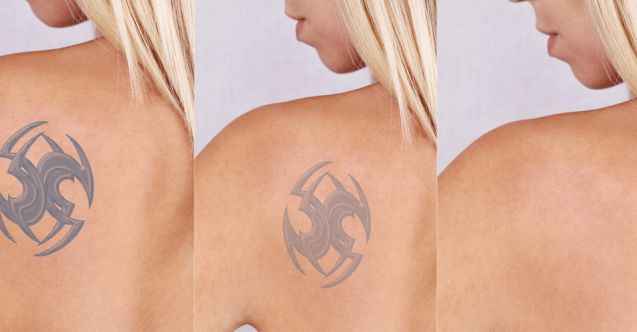 ipek kirpik ve kirpik laminasyon işlemi nasıl yapılır